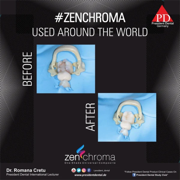 ZENCHROMA Universal Composite - Image 3